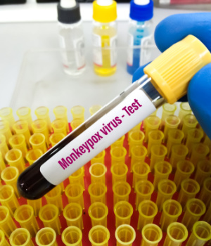 U.S. Monkeypox Testing Market Size & Share Analysis, Forecast